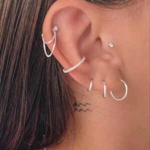 Aretes